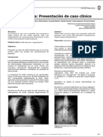 Colitis Ulcerosa Presentación de Caso Clínico Aproximadamente Rectosigmoide