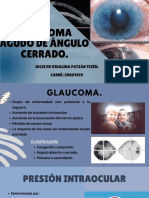 Glaucoma Agudo de Ángulo Cerrado