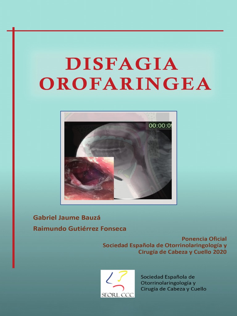 Ponencia Oficial Seorl CCC 2020 | PDF | Laringe | Anatomía humana