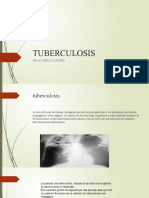Tuberculosis: Dra, Florelys Leones