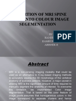 Convertion of Mri Spine Images Into Colour Image Segementation