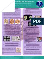 Alzheimer - Cartel de Neuroanatomía