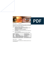 Ophthalmo Short Cases