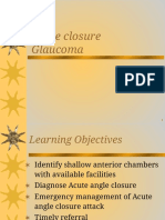 Angle Closure Glaucoma