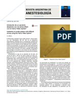 Carta AL Editor: Intubación de Un Paciente Despierto Con Vía Aérea Difícil Con El Clarus Video System