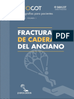 Fractura Cadera Anciano