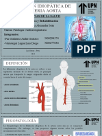 Dilatación Idiopática de La Arteria Aorta
