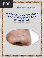 5 Mascarillas Faciales para Remover Las Espinillas