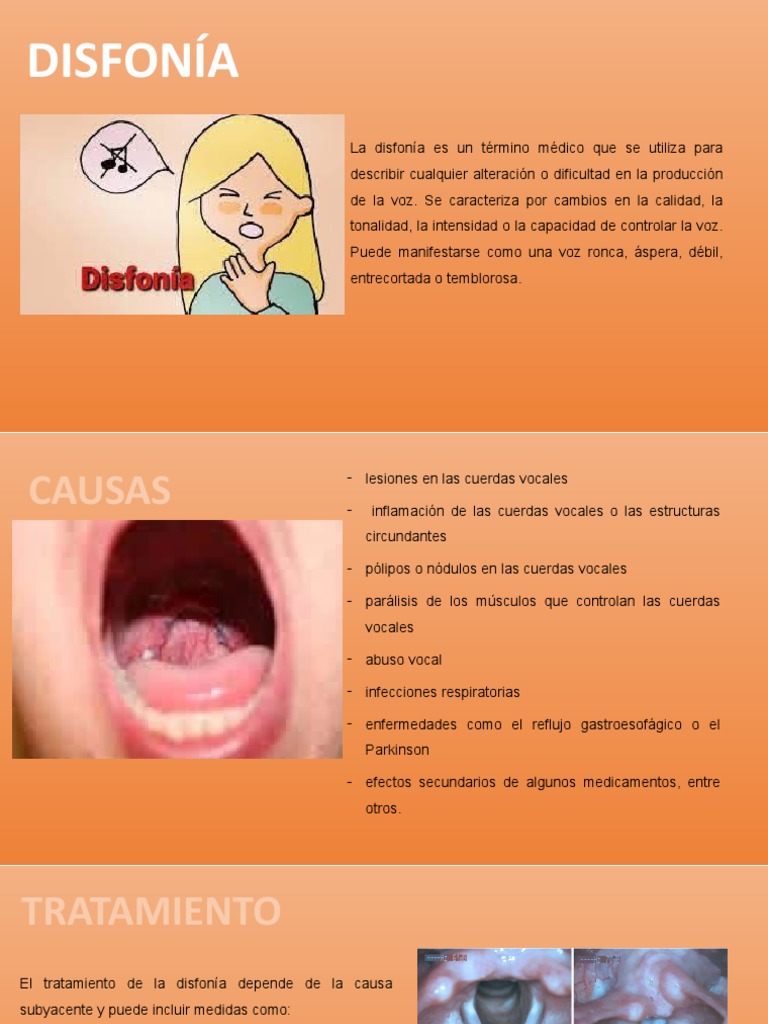 disfonia PDF