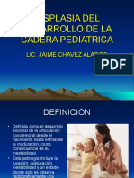 Displasia Del Desarrollo de La Cadera Pediatrica