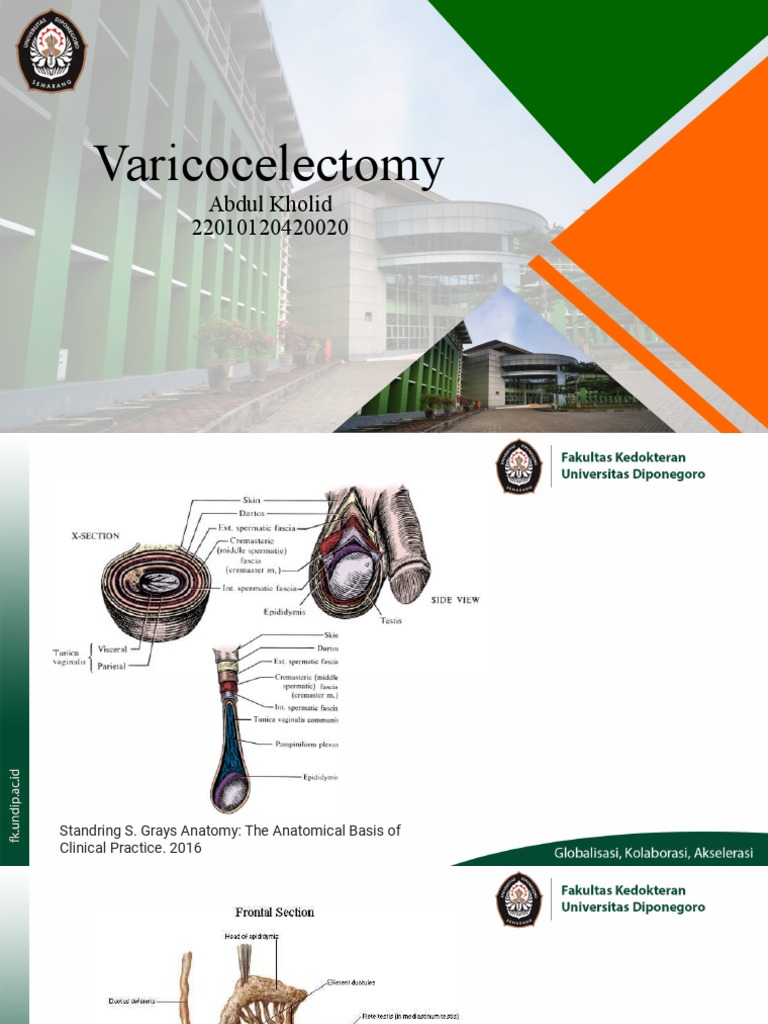 Optek Varicocelectomy Dengan Background Baru-1 | PDF | Kesehatan ...