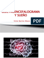 Electroencefalograma y Sueño