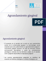 Agrandamiento Gingival