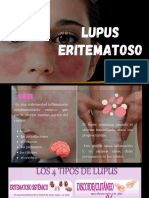 LUPUS 