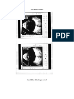 Hasil USG Mata Normal