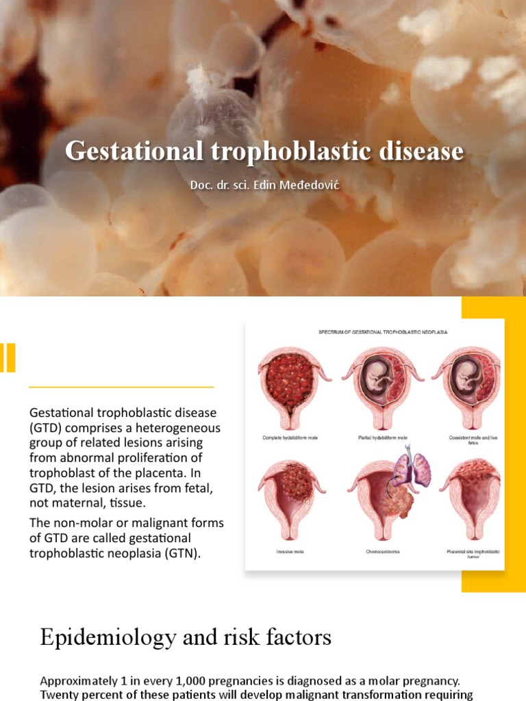 Overview of Gestational Trophoblastic Disease | PDF | Human Chorionic ...