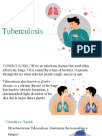 Tuberculosis