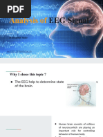 Analysis of EEG Signals