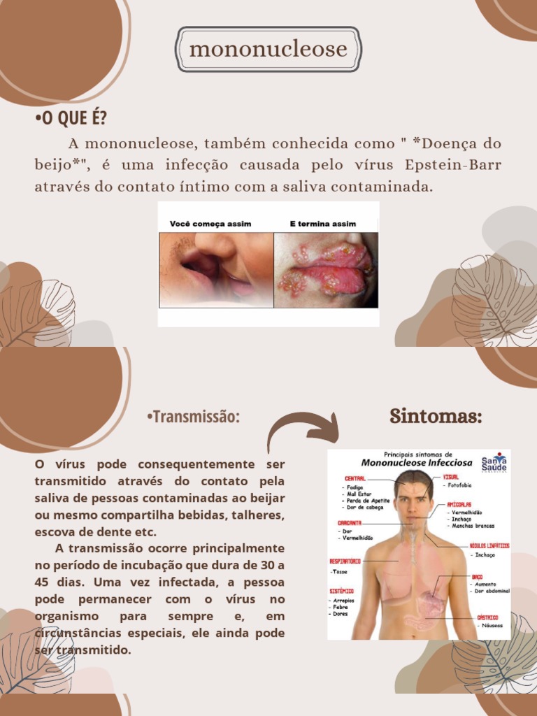 Mononucleose | PDF