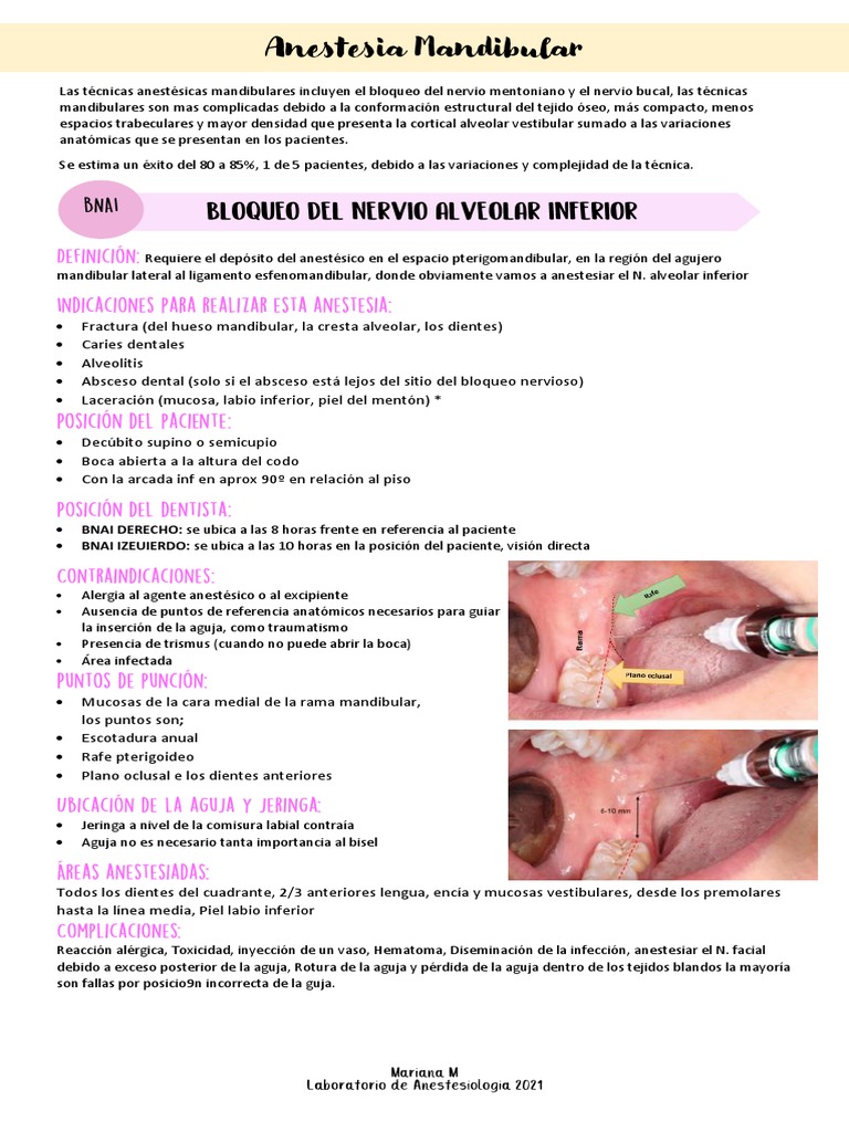 Técnicas de Anestesia Mandibular | PDF | Boca | Diente
