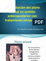 Rehabilitaciòn Del Plano Oclusal en Sentido Anteroposterior Con