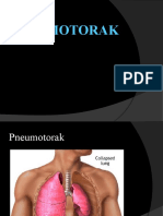 Pneumo To Rak