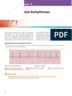 Atria Arrythmia Test