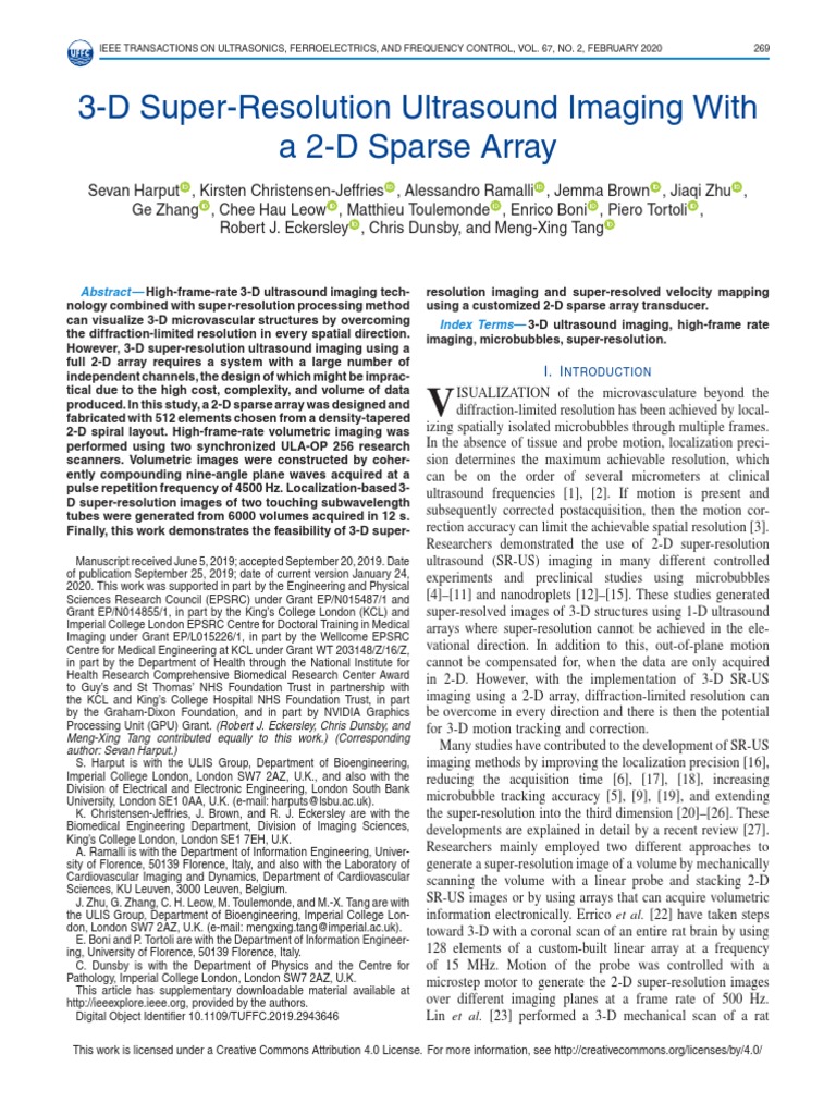3-D Super-Resolution Ultrasound Imaging With A 2-D Sparse Array | PDF ...