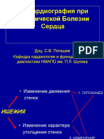 Echocardiography in Ischemic Heart Disease (In Russian)