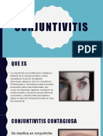 Conjuntivitis