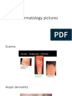 All Dermatology Pictures