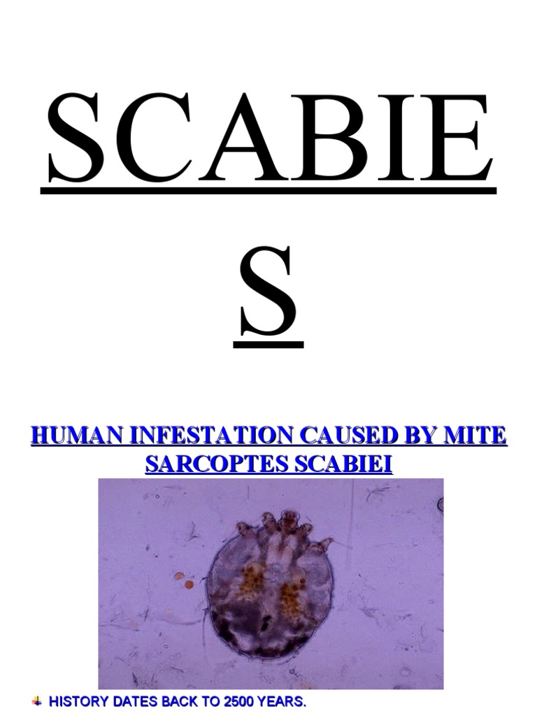 Scabies 1 PDF Medicine Causes Of Death