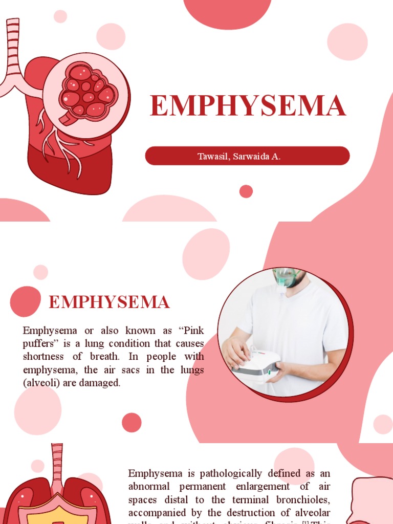 Emphysema Breakthrough | PDF | Chronic Obstructive Pulmonary Disease | Lung