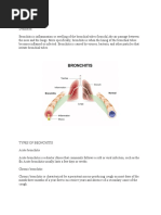 What Is Bronchitis 2