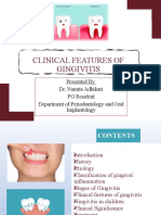 Clinical Signs of Gingivitis