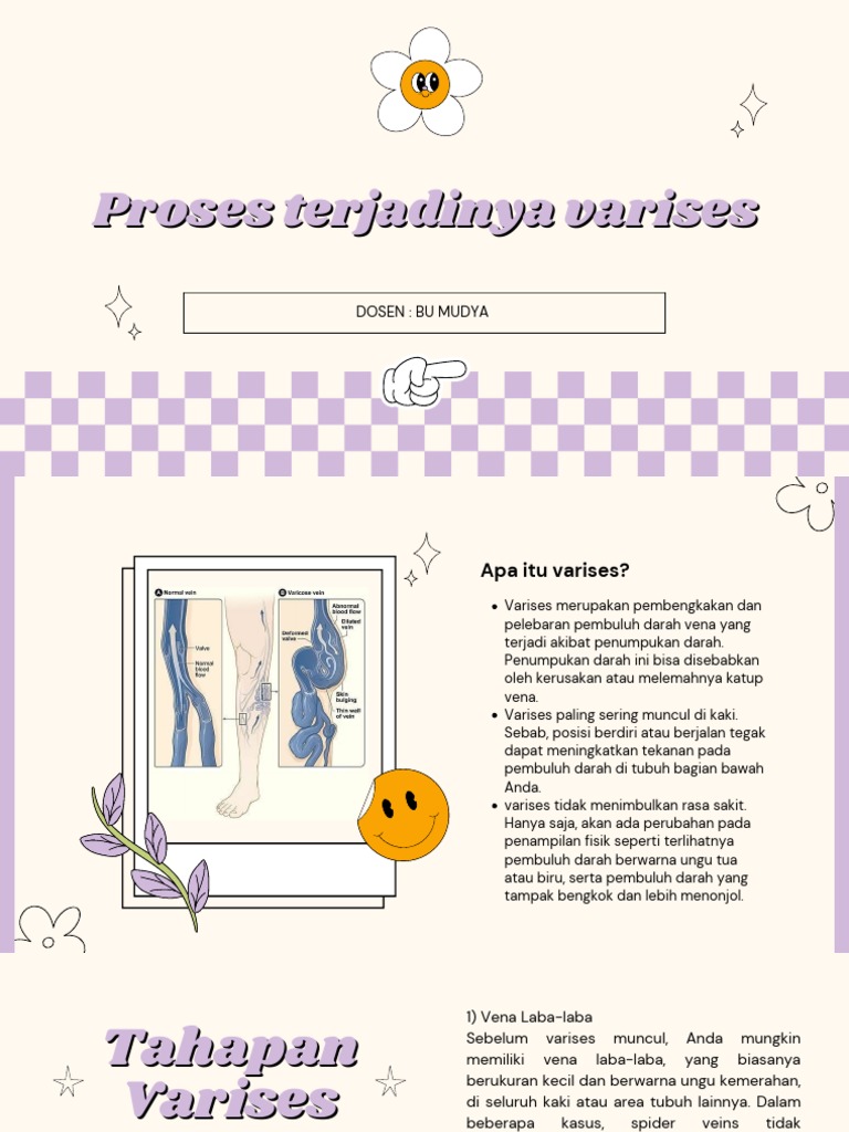 Proses dan Tahapan Varises Kaki | PDF