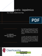 Cardiopatía Isquémica