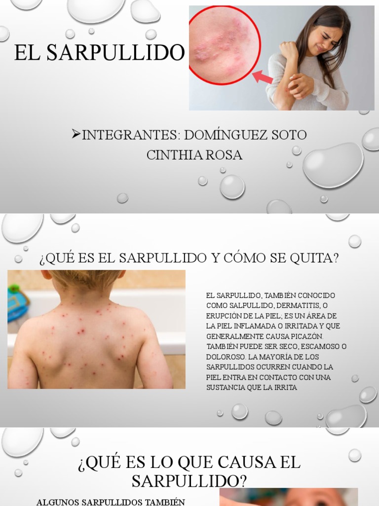 El Sarpullido | PDF | Salud y bienestar