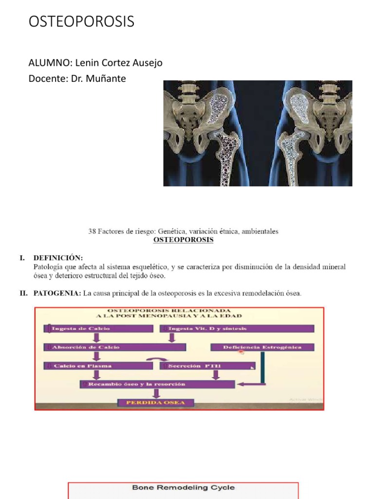 thumbnail image 2 of Osteoporosis: A Guide For Clinicians - Camacho, Pauline M., M.D.; Miller, Paul D 2 of 9