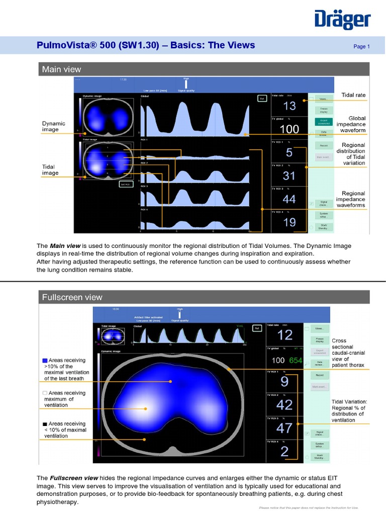 Pulmovista 500 Erfahrungen _ ICU Ventilation and Respiratory Monitoring ...