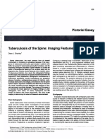 Tuberculosis of The Spine - Imaging Features