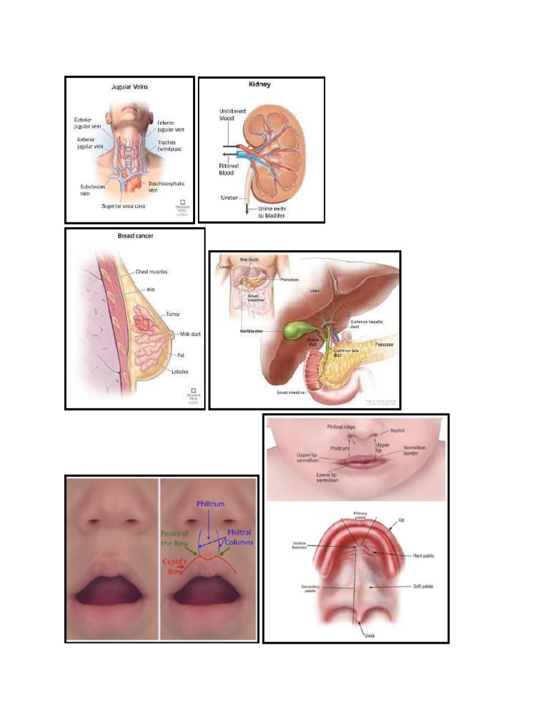 Cleft lip and cleft palate intelligence overview