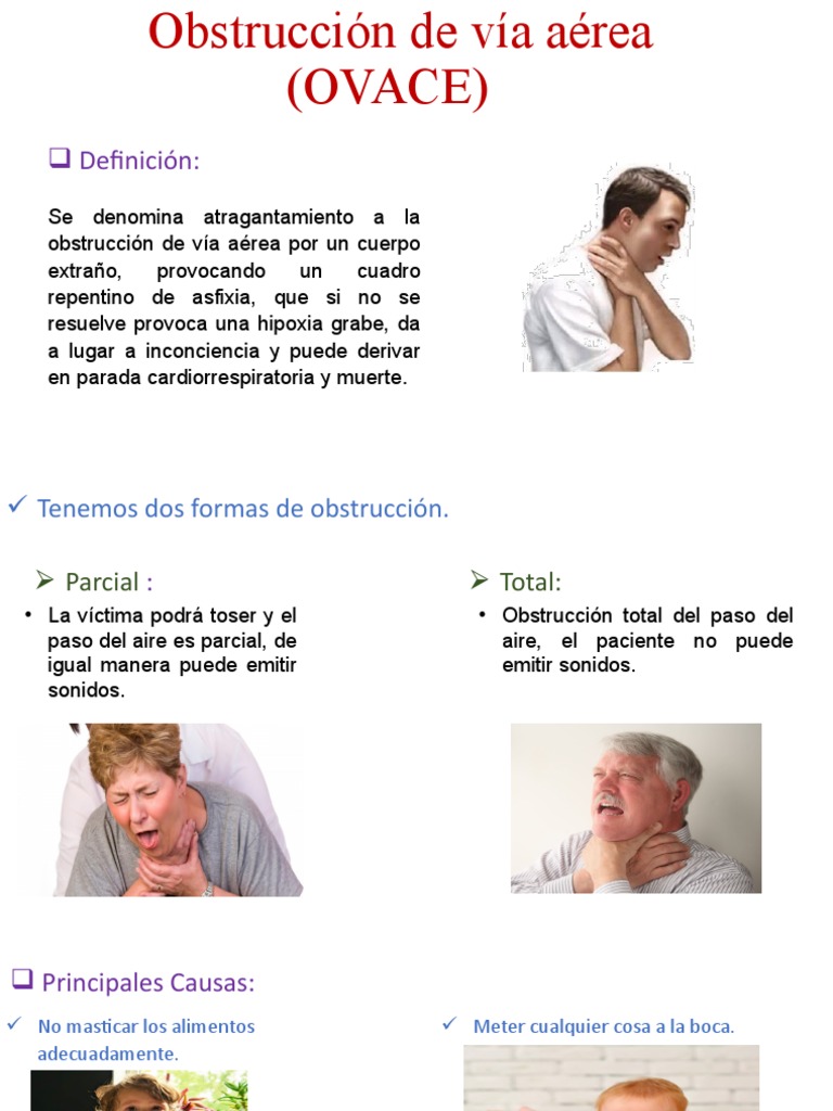 Signo De La Escalera (obstrucción Intestinal) En Radiografía De Abdomen