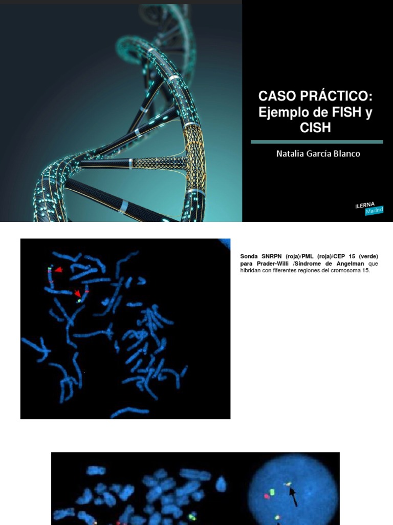 Ejemplos de FISH y CISH en genética | PDF | Ciencia y matemáticas ...