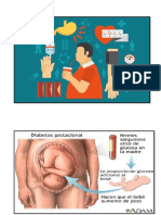 Tarea Diabetes