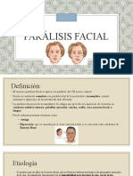 Paralisis Facial Terminado Ahora Si