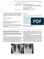 Mujerjovencondisfuncio ́nbiventricularysı ́ndromeinflamatoriomultisiste ́micopedia ́tricotraslaCOVID-19