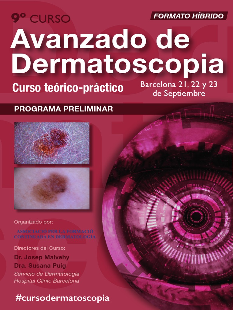 Curso - Avanzado - Dermatoscopia - v11-1 - (1) - Removed - (1) 2 | PDF ...