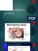 Valvulopatia mitral