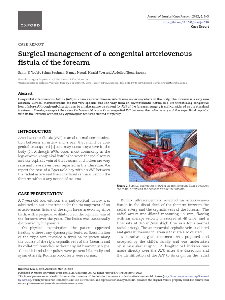 21 Surgical Management of A Congenital Arteriovenous | PDF ...